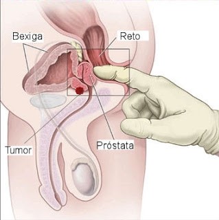 Anatomia masculina, localização da próstata